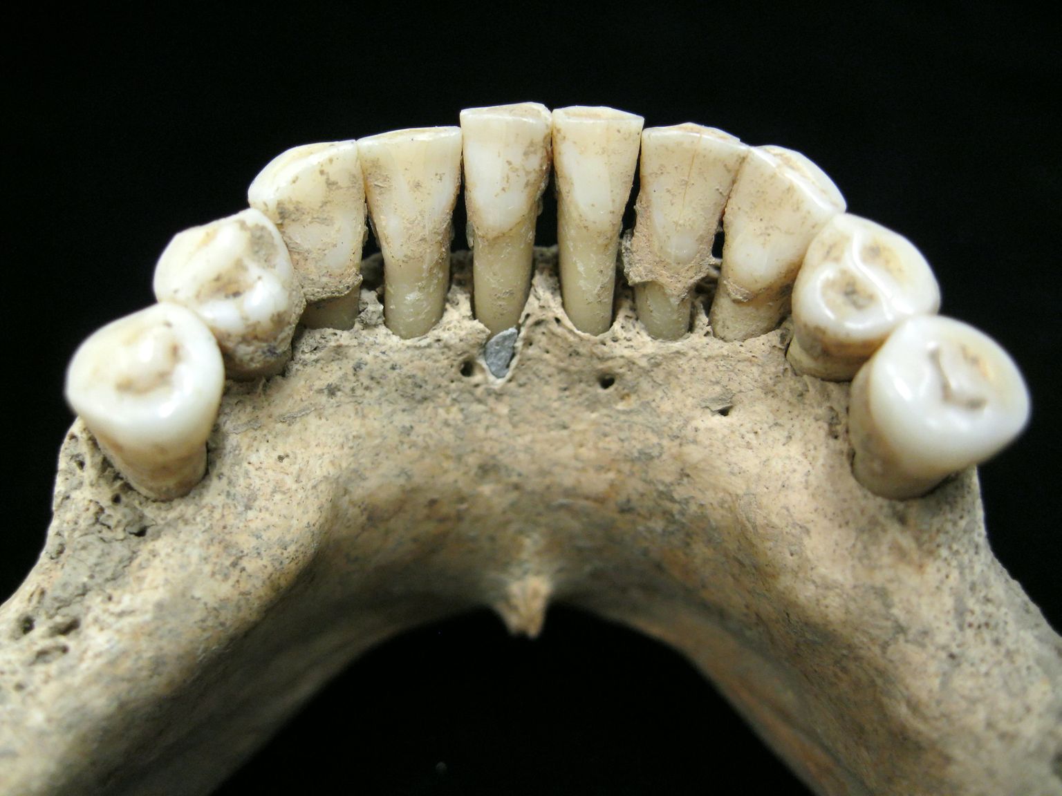 Üle 900 aasta tagasi elanud naise hammastelt leiti ultramariinisinist pigmenti
