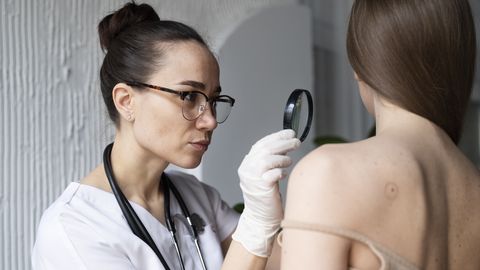 Nädalas 32 uut nahavähi diagnoosi: arstidel on eestlastele üks oluline sõnum