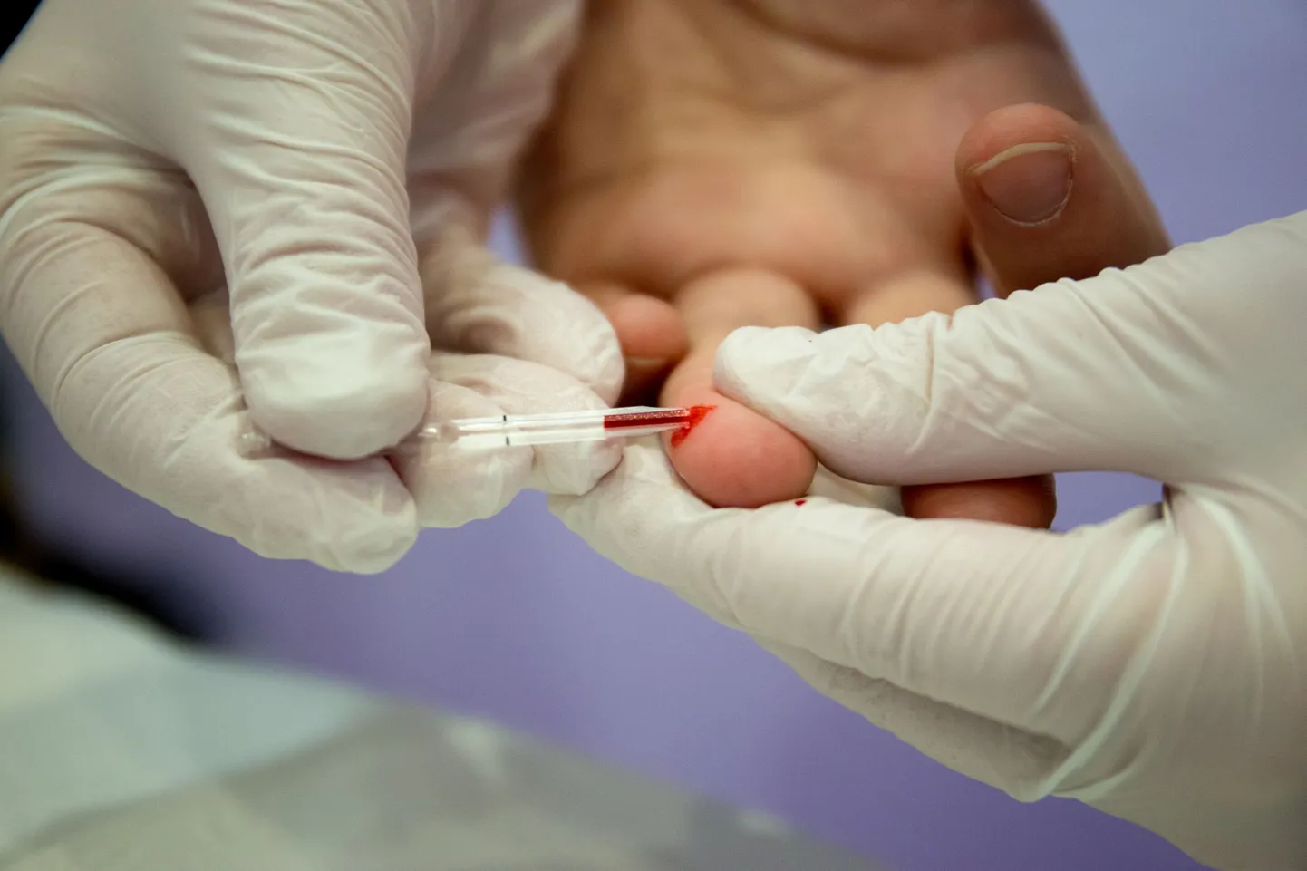 HIV-testimine võtab vaid paar minutit.