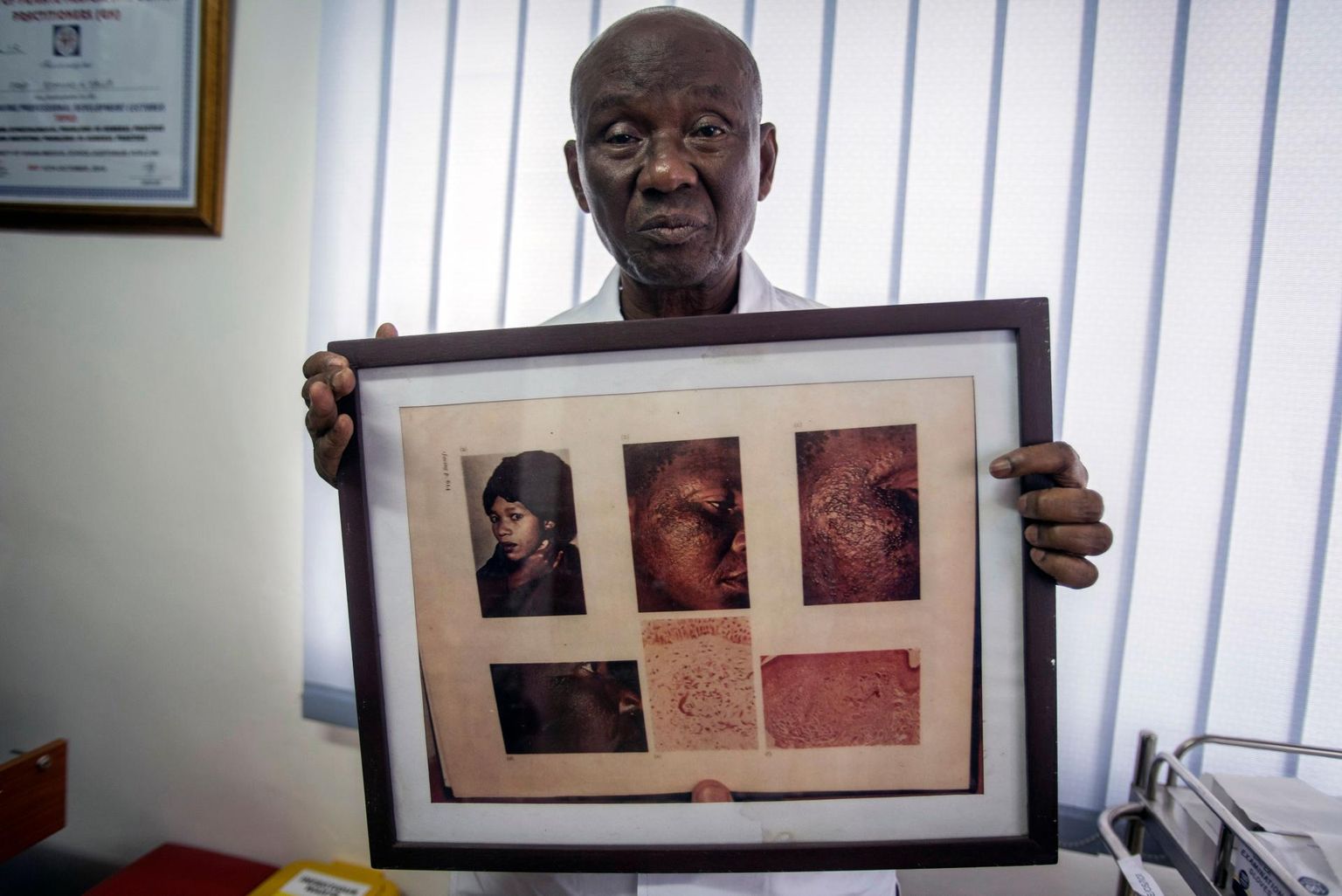 Ghana dermatoloog Edmund Delle näitab pilti tõsise nahaprobleemiga naisest, kes kasutas aastaid hüdrokinooni sisaldavat nahapleegituskreemi.