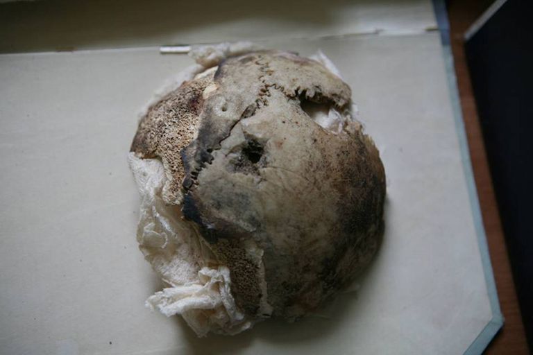 Часть черепа Адольфа Гитлера