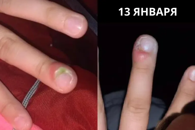 Ногти пострадавшей Лорен