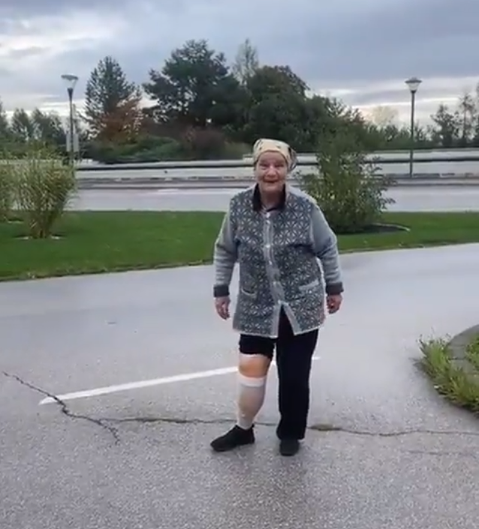 72-aastane ukrainlanna näitab, kuidas jalaproteesist hoolimata tantsida,