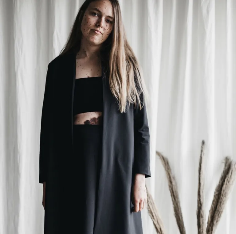 Mathilde Arctander, kelle kehal on palju sünnimärke