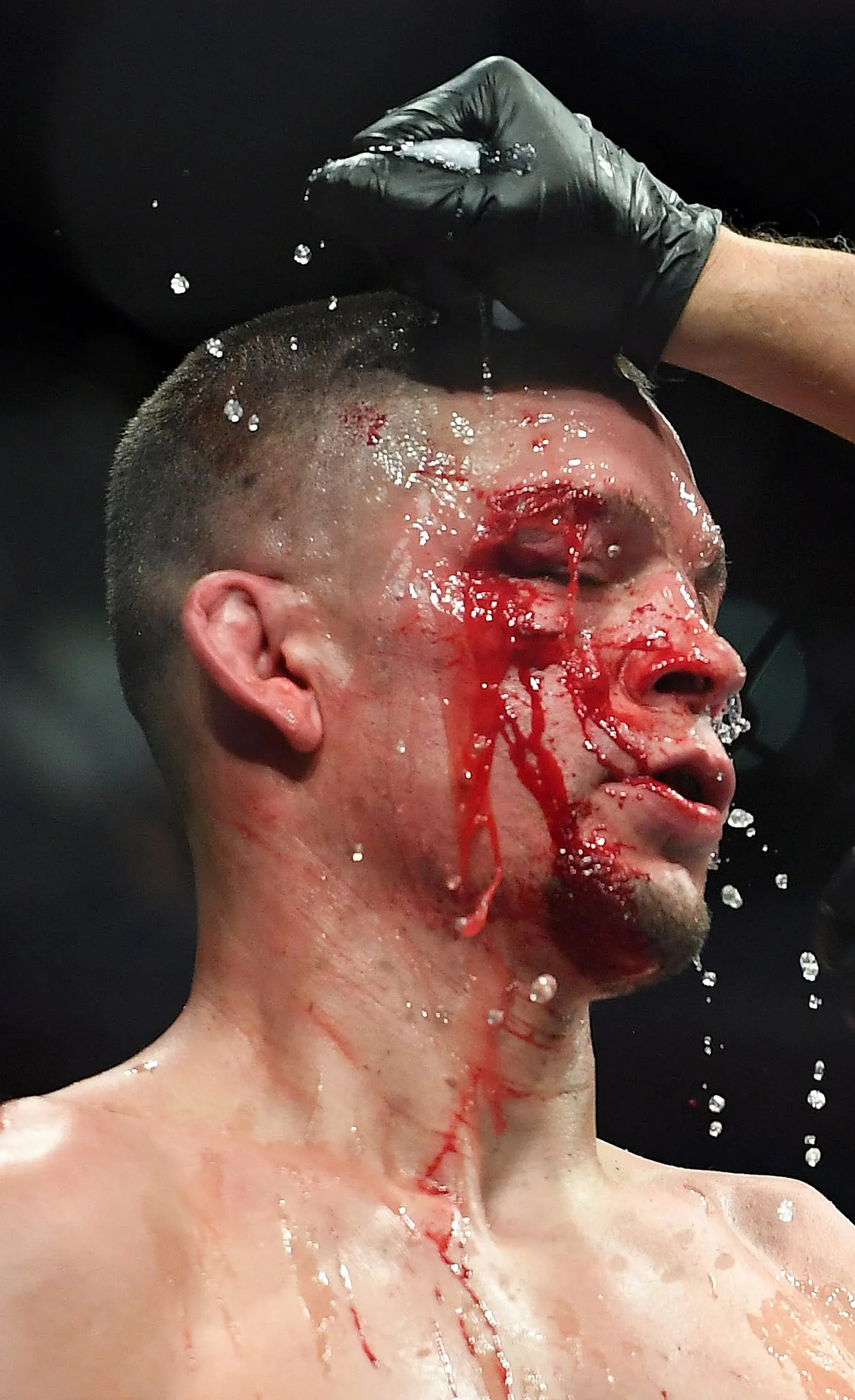 Nate Diaz.