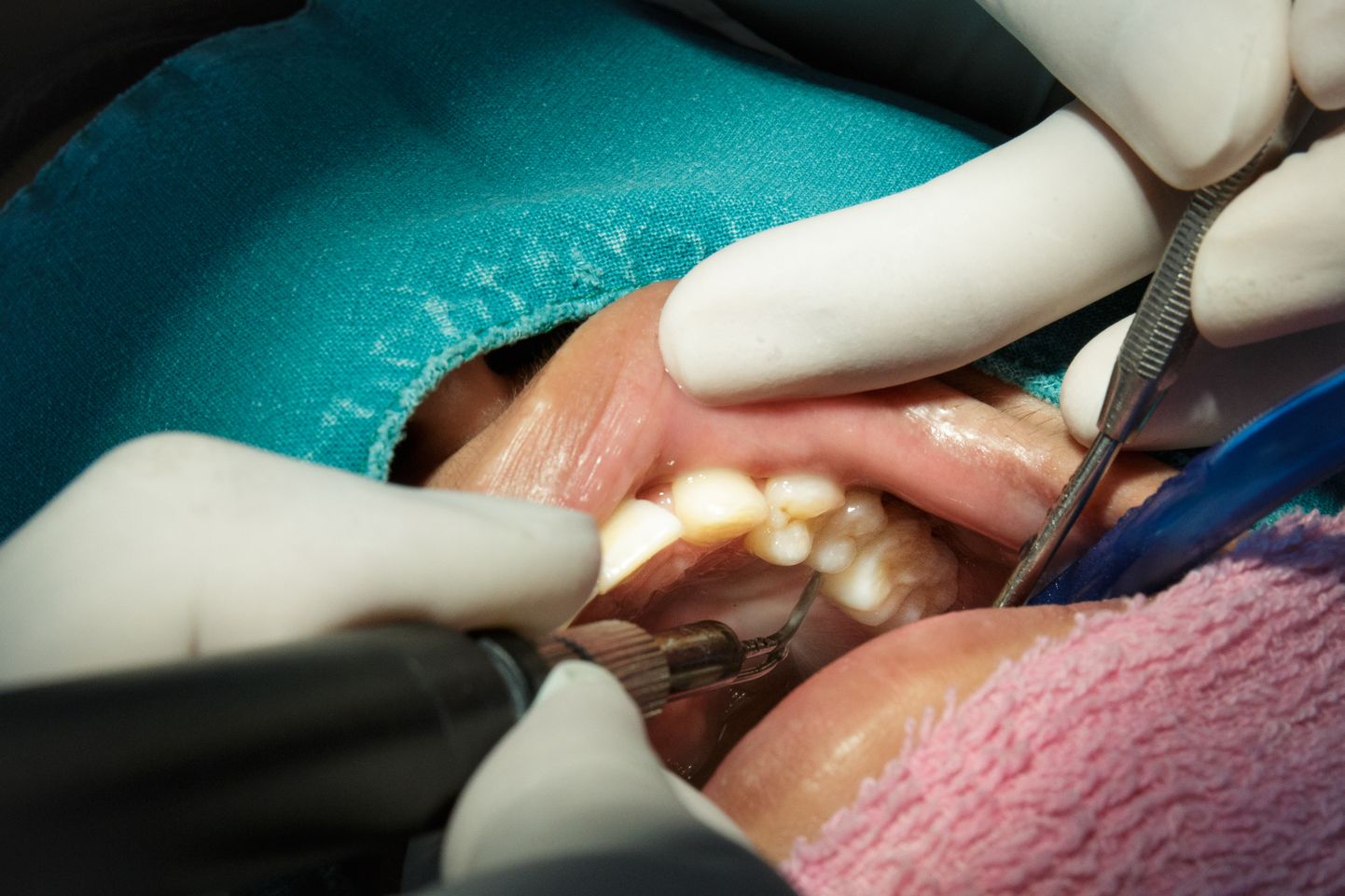 Süüdi mõistetud hambakirurg eiras korduvalt sanitaarnõudeid.