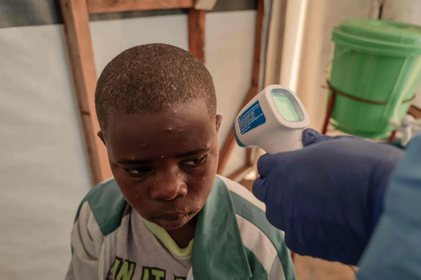 Пациенту измеряют температуру в центре лечения Mpox в больнице общего профиля Ньирагонго, к северу от Гомы, 17 августа 2024 года. С начала года в Демократической Республике Конго зарегистрировано около 16 000 случаев заболевания, и именно ДРК является центром и эпицентром эпидемии, из-за которой Всемирная организация здравоохранения (ВОЗ) в среду объявила высший уровень тревоги на международном уровне.