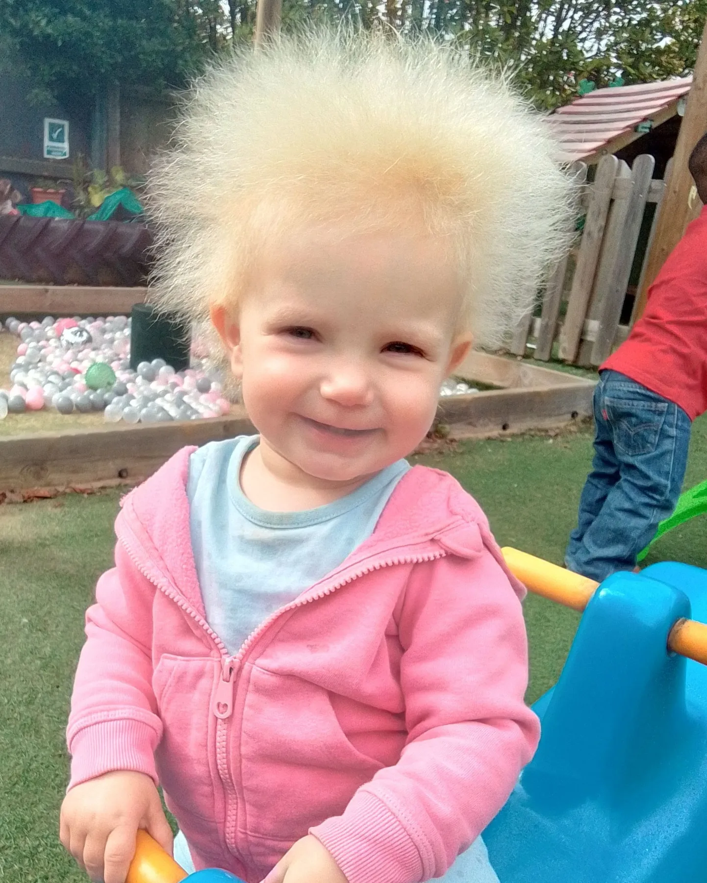 Väike nunnu Kolumatsi sündroomiga Layla Davis