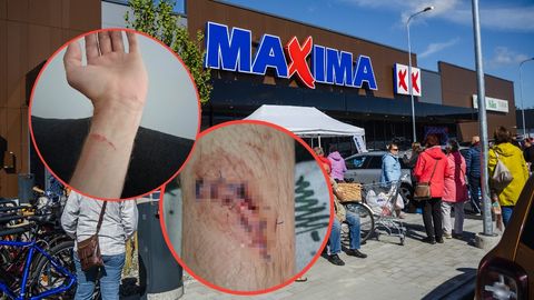 FOTOD ⟩ «Lõikas nagu noaga, luuni välja». Šokeeriv õnnetus Maxima uues poes tõstatas tõsised ohutusküsimused
