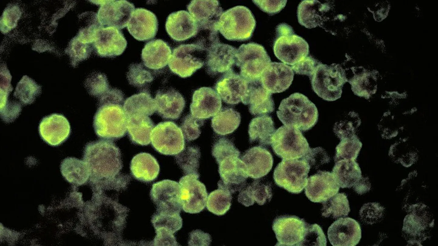 Амебный менингоэнцефалит, вызванный паразитом Naegleria fowleri, под микроскопом.