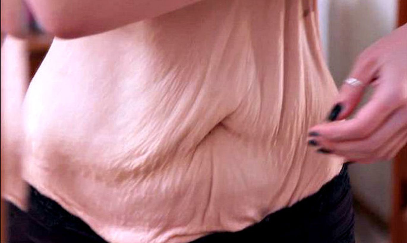 грудь обмякла при беременности фото 82