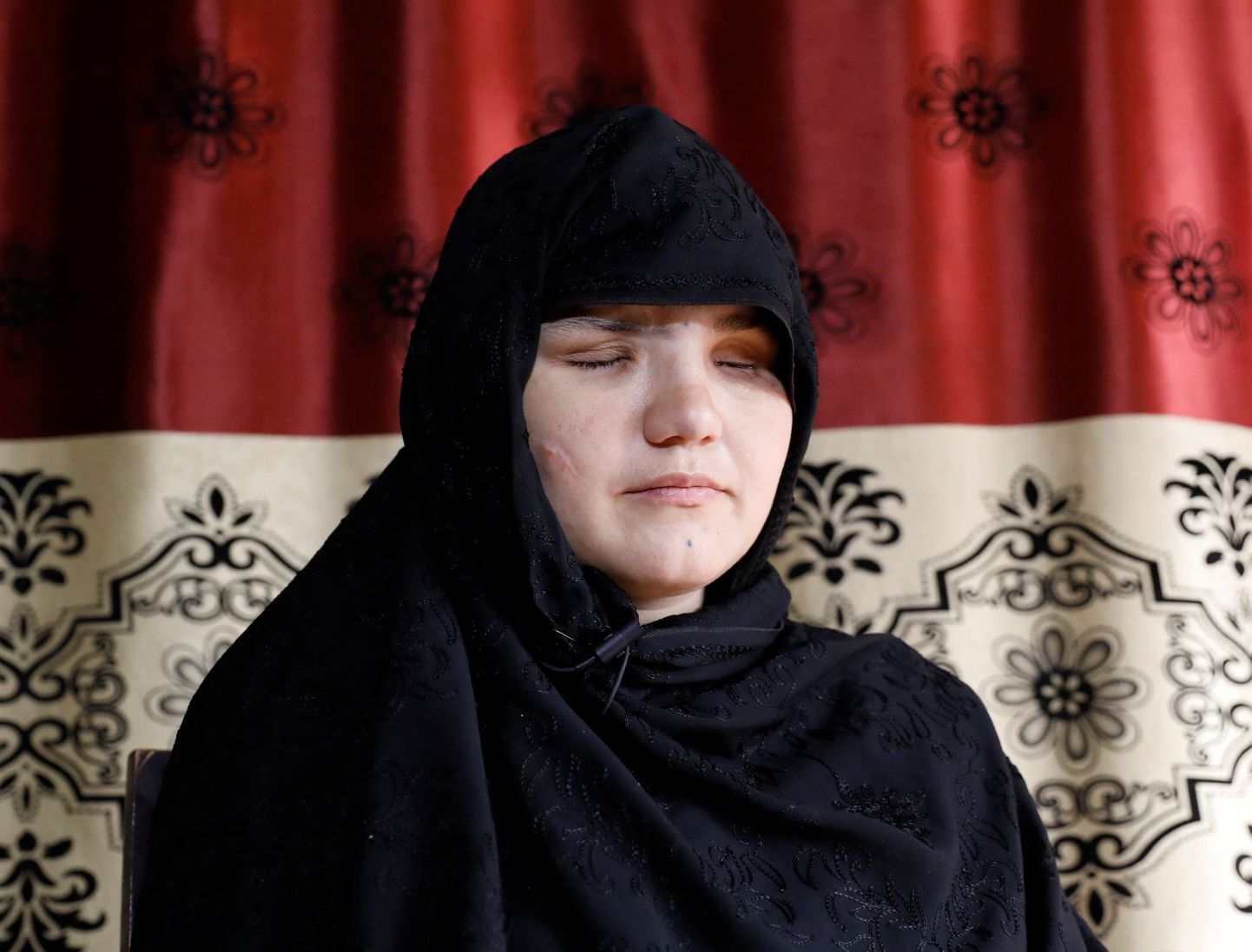 Khatera kaotas Talibani rünnaku käigus mõlemad silmad.