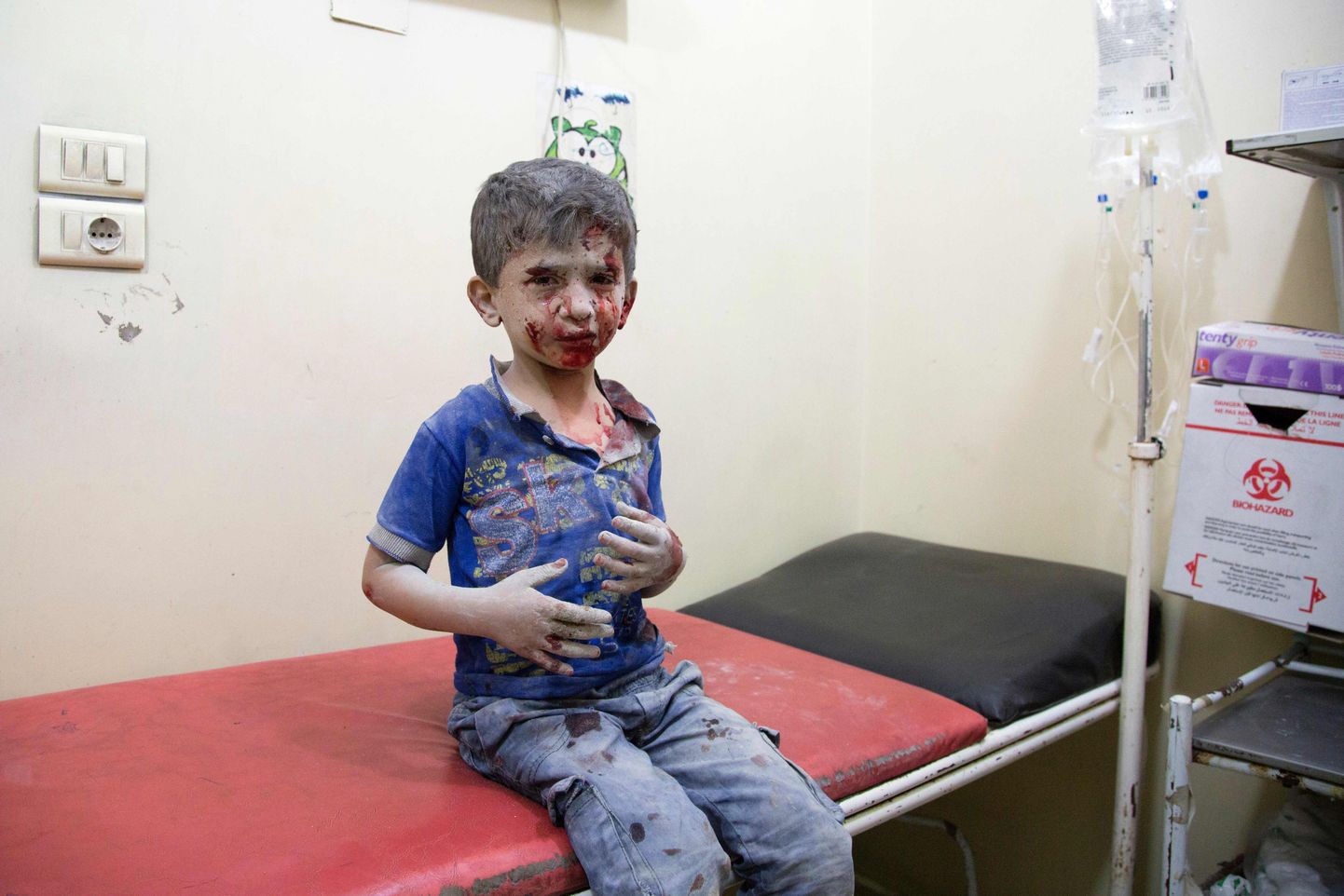 Aleppo pommitamises kannatada saanud poiss.