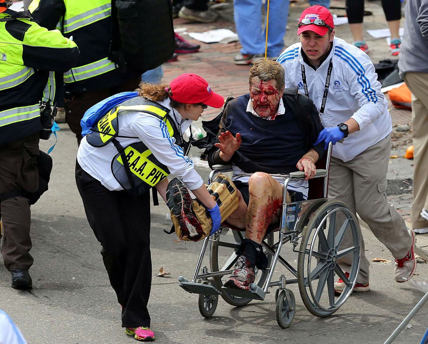 Bostoni pommiplahvatustes kaotasid kaks venda kumbki ühe jala