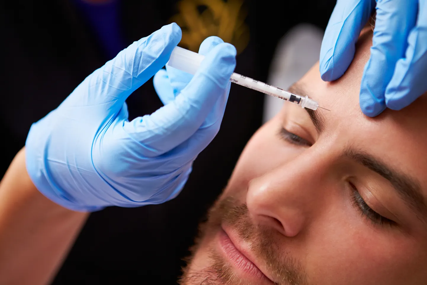 Botox halvab miimikalihased