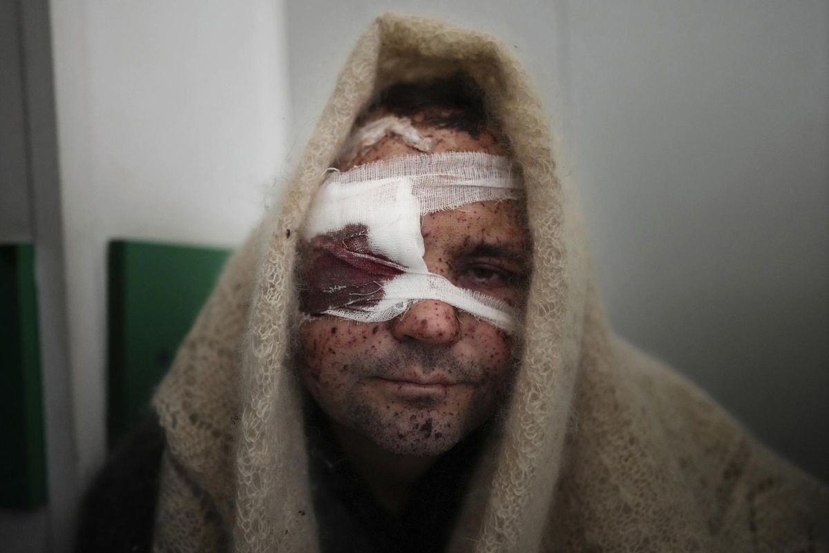 Vigastatud ukraina mees Mariupoli haiglas, 11. märts 2022.
 