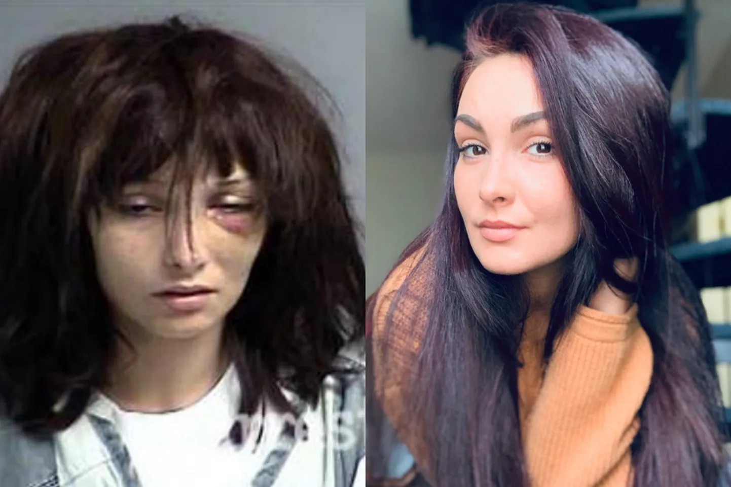 Madison McManus enne ja pärast. Elu24 kollaž.