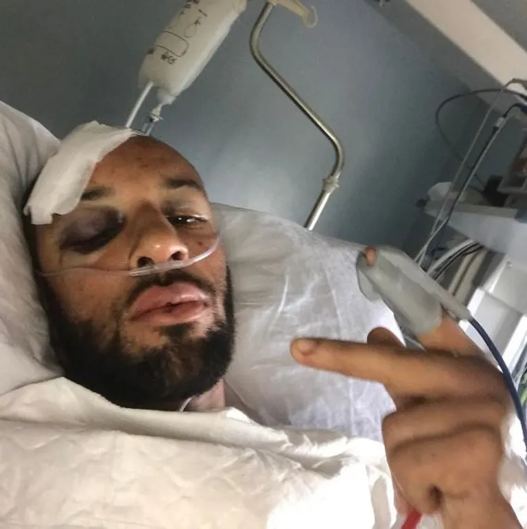 James Ellington jaanuaris haiglavoodis pärast mitmeid operatsioone.