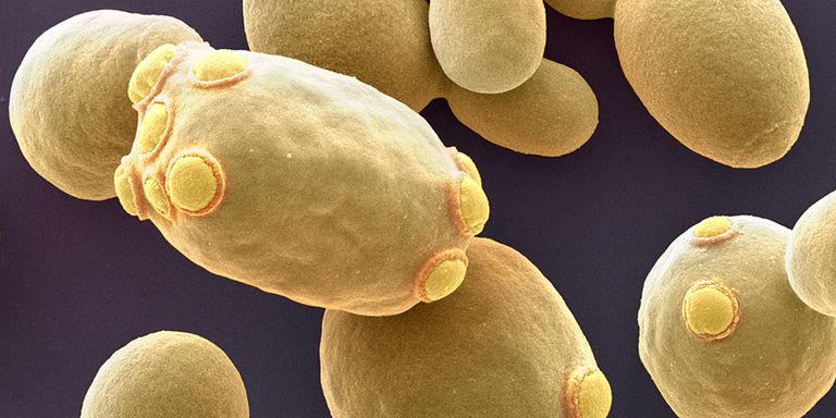 Ringmajandusliku tulevikutööstuse ühed tööpinkiest – pärmid. Pildil Saccharomyces cerevisiae e. pagaripärmi rakud.