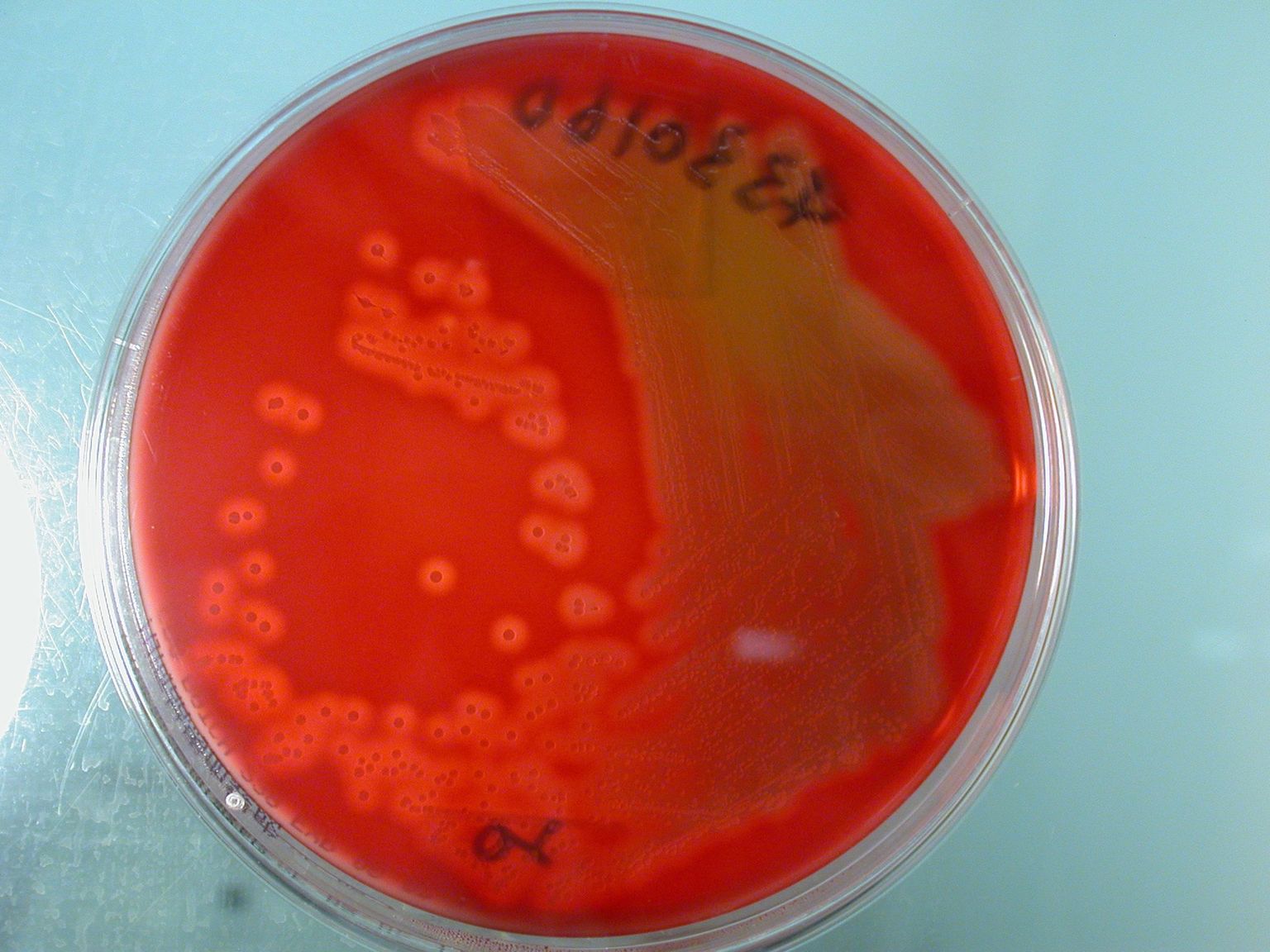A-grupi streptokoki bakterid