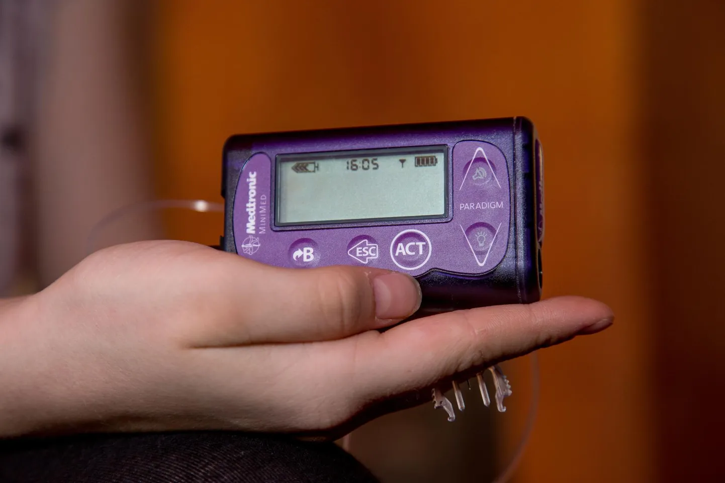Insuliinipump.