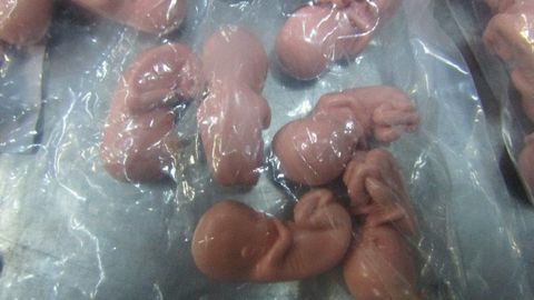 Фото ⟩ «Не игрушка!»: жительница Эстонии пыталась провезти в Россию 200 человеческих эмбрионов
