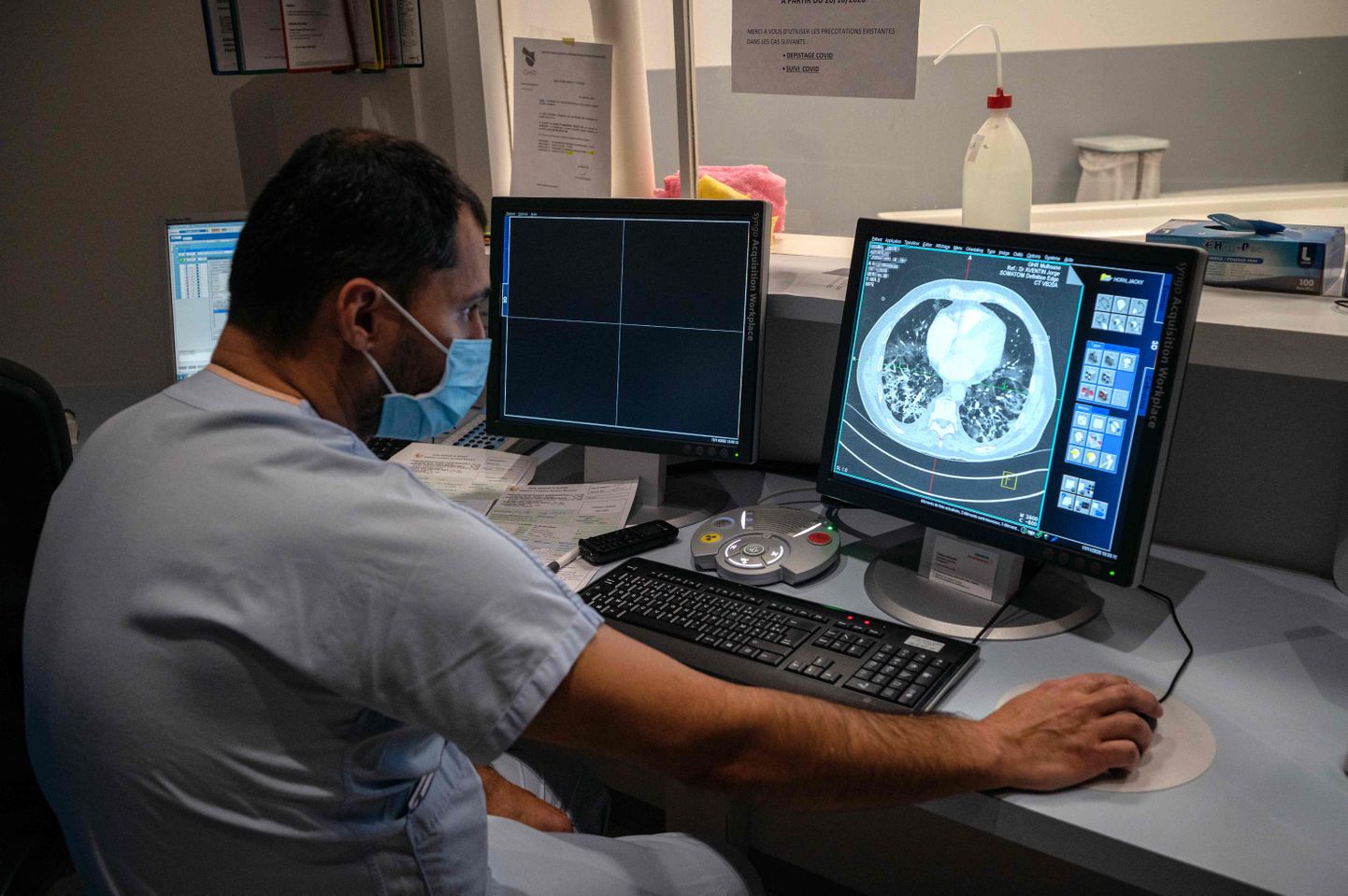 Illustreerival pildil kontrollib radioloog kompuutertomograafia uuringul tehtud pilti koroonapatsiendi kopsudest Emilie-Mulleri haiglas Prantsusmaal (17.11.2020).