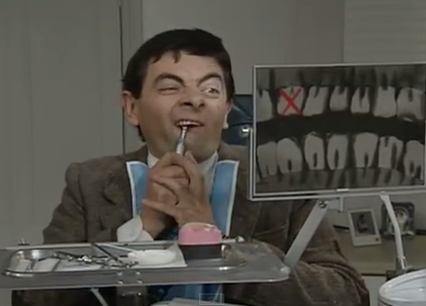 Ka briti armastatud telekangelane mister Bean tegeleb iseenda hammaste raviga.