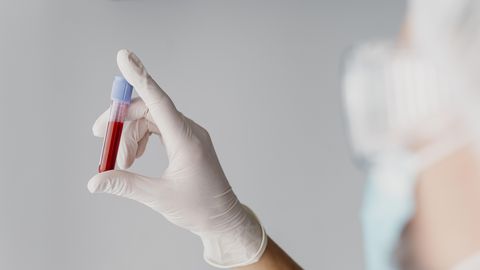 Uuring: konkreetne veregrupp suurendab diabeedi riski