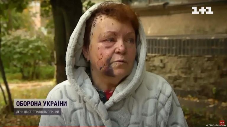 Александра Киселева, была ранена во время ракетных обстрелов Киева 10 октября. На фото она дает интервью украинскому телеканаду 1+1