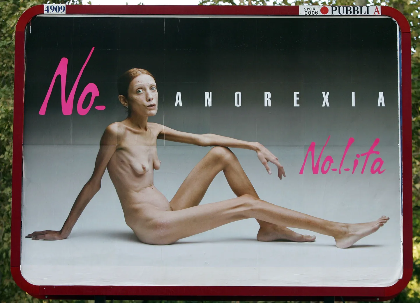 Французская актриса Изабель Каро, страдавшая от анорексии.