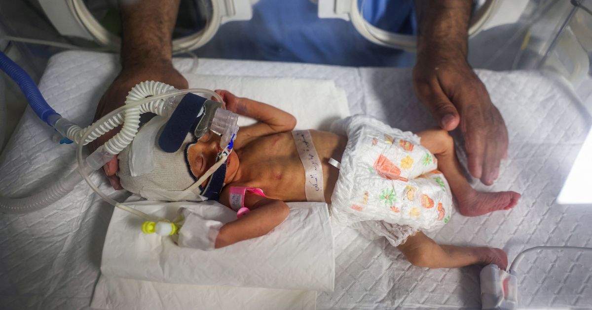 Miracolul nu s-a născut ⟩ Copilul care a fost salvat din pântecele mamei sale, care a fost ucis într-un atac aerian asupra Gaza, a murit datorită eforturilor medicilor
