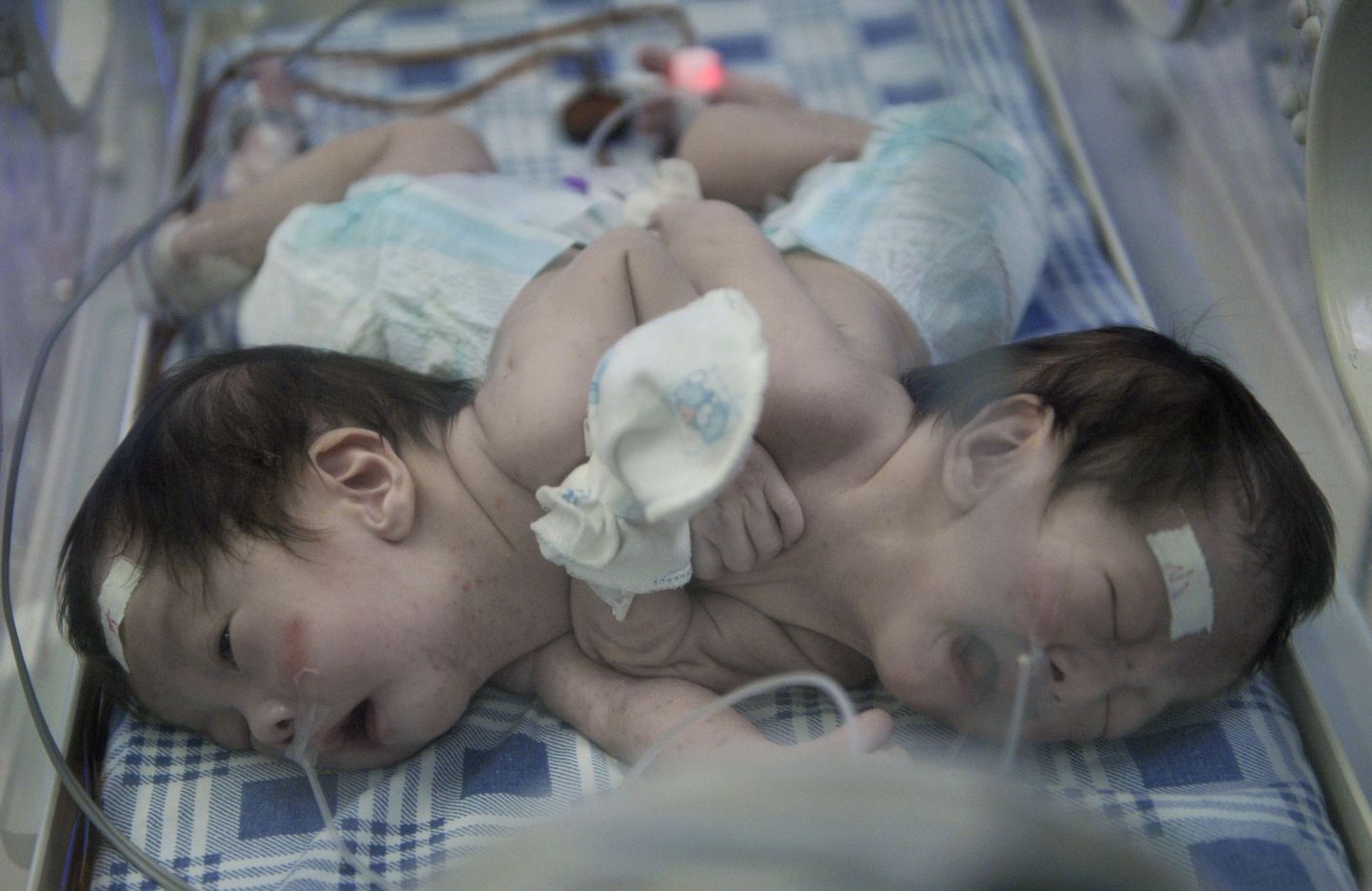 Hiinas selle kuu alguses sündinud Siiami kaksikud