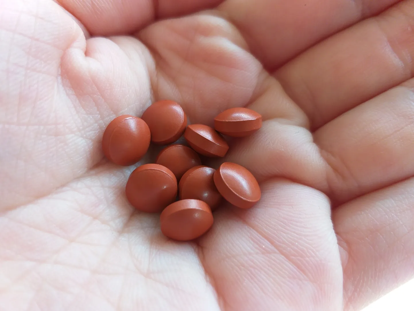 Aneemia üks sümptomitest on väsimus.