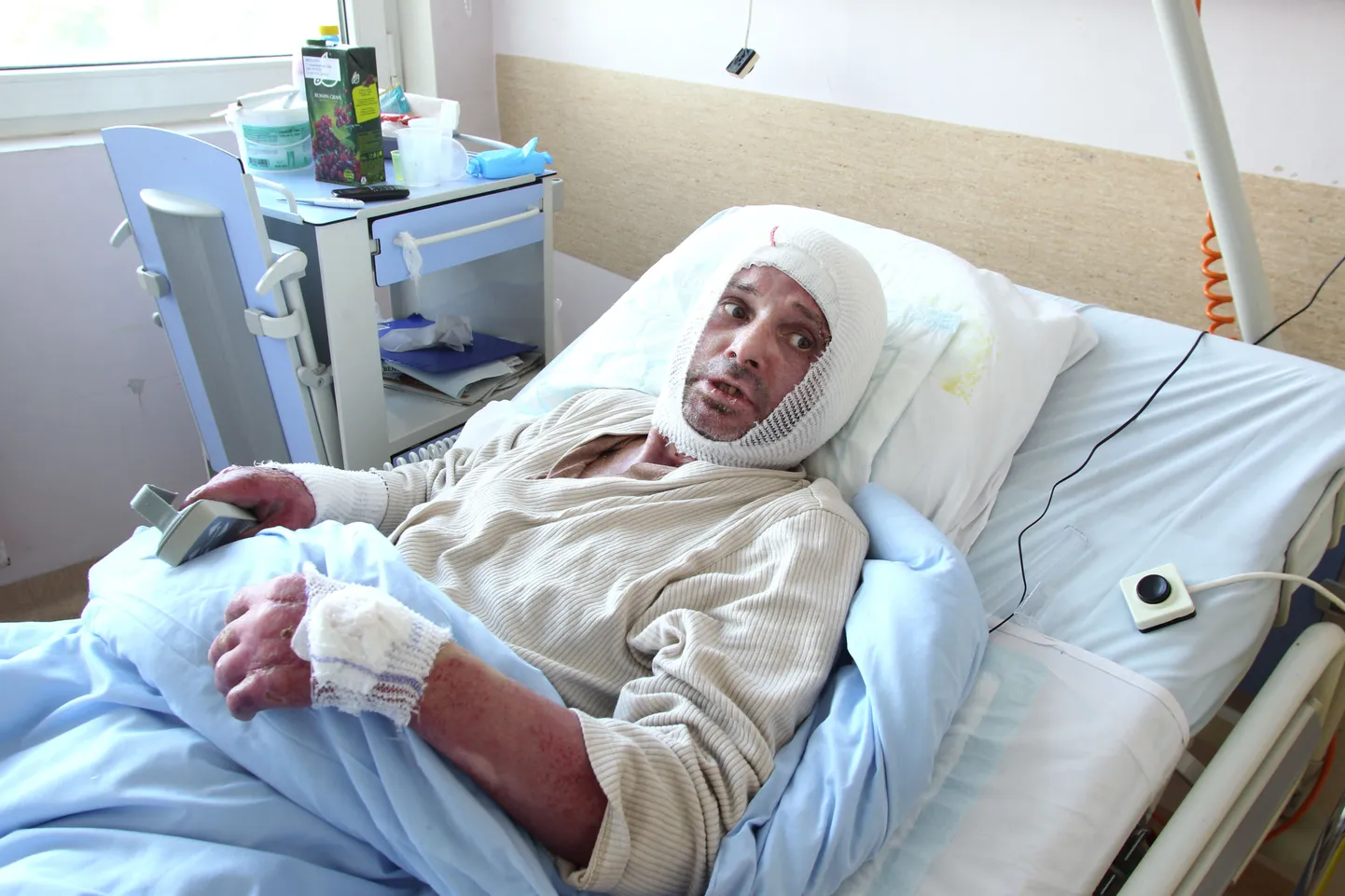 Сергей Шлабович обгорел настолько, что поначалу не было уверенности в том, что он останется в живых. Но врачам удалось сотворить чудо.