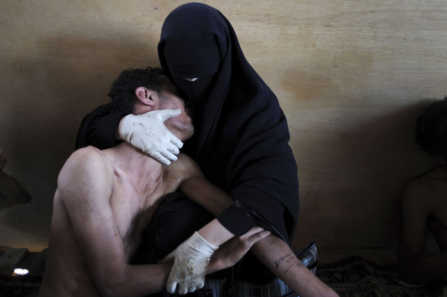 Главный приз: фотография Самуэля Арланда. Жительница Йемена держит своего раненого родственника.