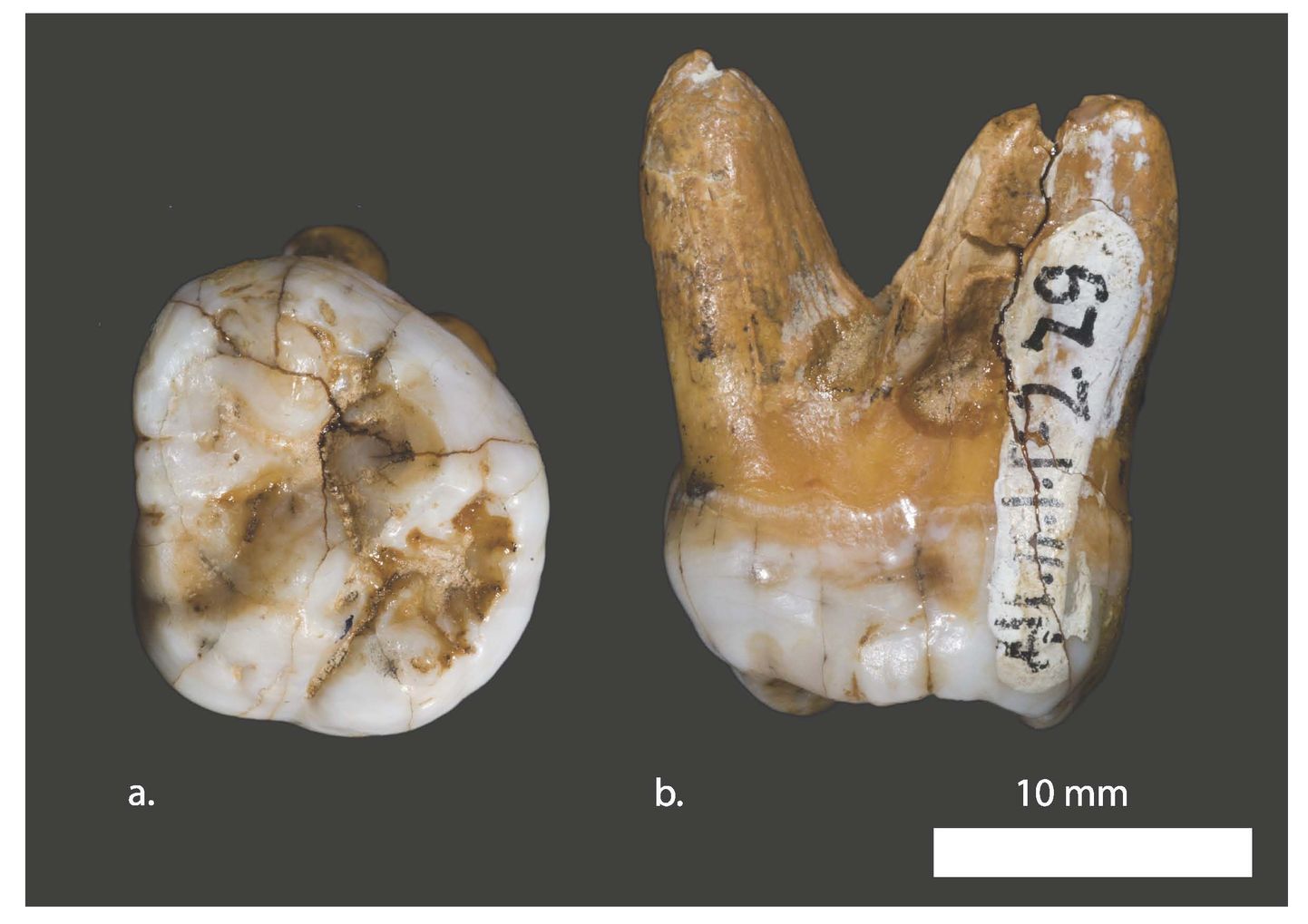Denisova inimese hambad. Pilt on illustreeriv.