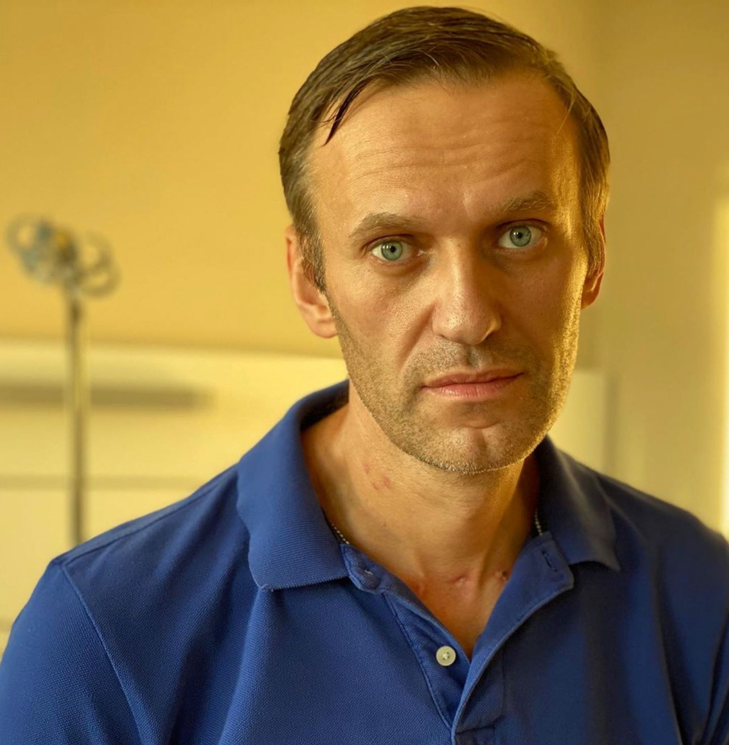 Vene opositsioonipoliitik Aleksei Navalnõi Berliini Charité haiglas. Eile pääses ta sealt välja.