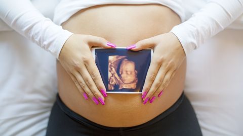 Surmav raseduse tüsistus, millest paljud pole kunagi kuulnud