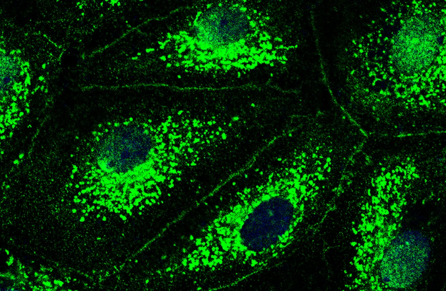 Kopsu veresoonte rakkude fluorestsentsmikroskoobi pilt. Uuring näitas esimest korda, et neil rakkudel on CFTR-kloriidkanalid (roheline). Kopsupõletik põhjustab nende ioonkanalite töö häirumise, mis omakorda suurendab kopsuveresoonte läbilaskvust. Mis omakorda tähendab, et kopsu alveoolid täituvad põletikulise vedelikuga ega saa varustada keha hapnikuga. Rakutuumad paistavad ümarate tumedate laikudena ja rakumembraanid peenete joontena.