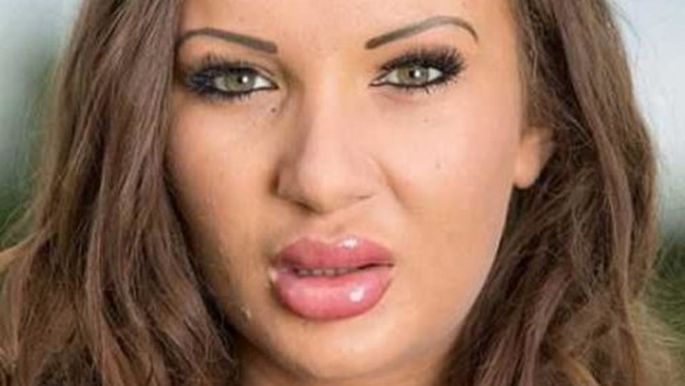 Как сейчас выглядит девушка с самыми большими в России накачанными губами
