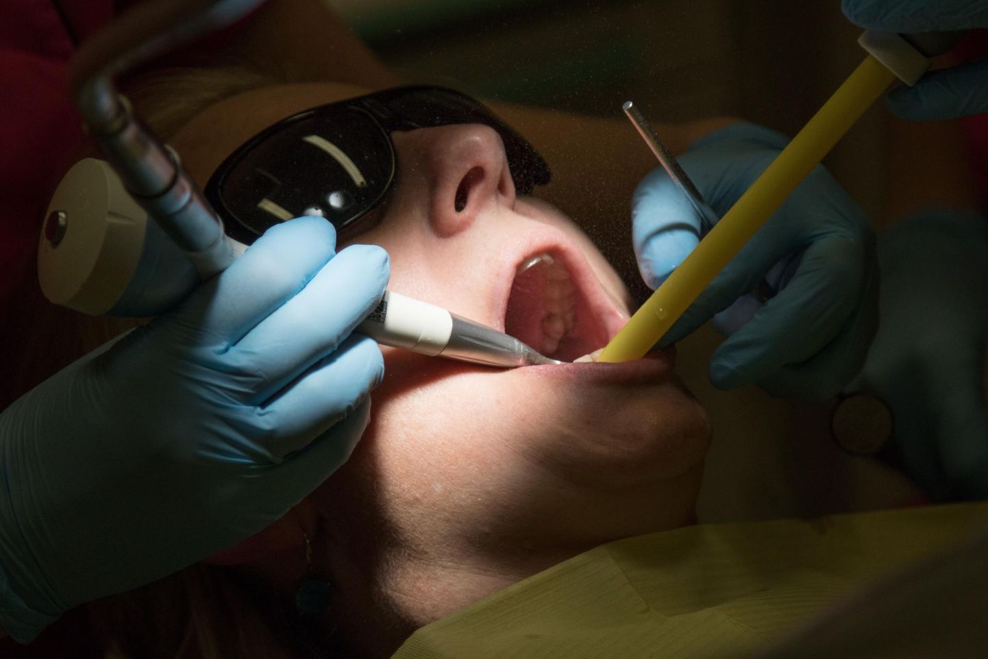 Haigekassa esmatasandi valdkonna juhi Külli Friedemanni sõnul on amet hambaarstidelt saanud tagasisidet, et neid külastavad inimesed, kes ei ole pikalt või kunagi varem nende vastuvõtul käinud.