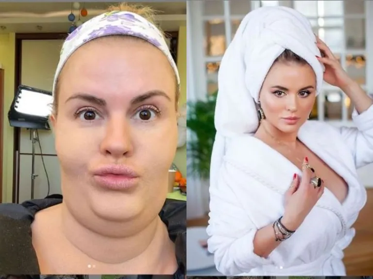 Анна Семенович