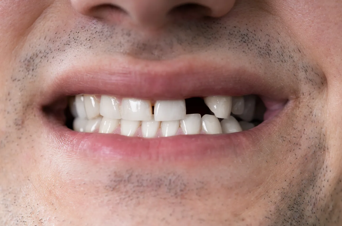 Varsti võib muutuda uute hammaste saamine lihtsamaks.