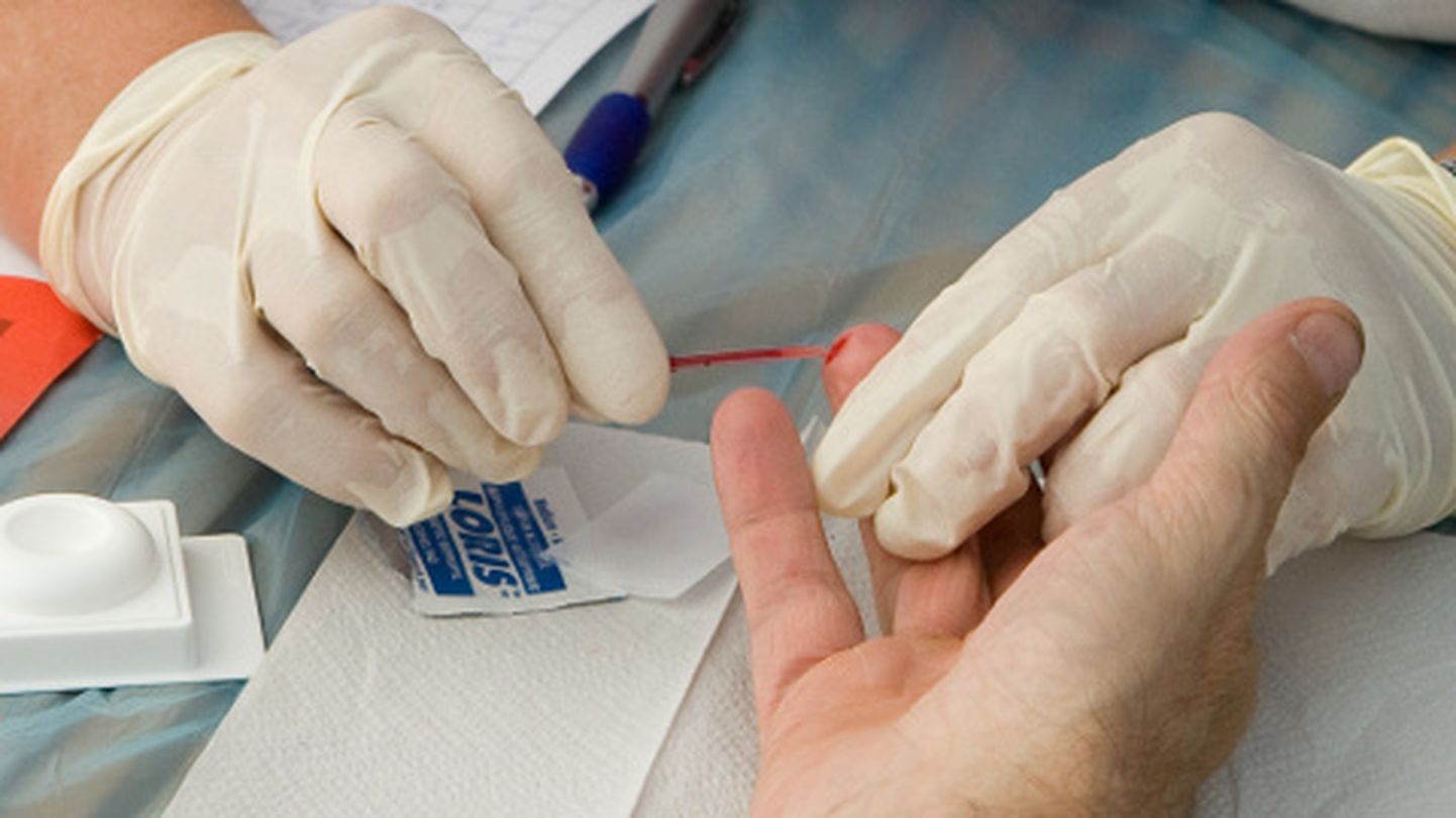 HIV-nakkuse testimine.