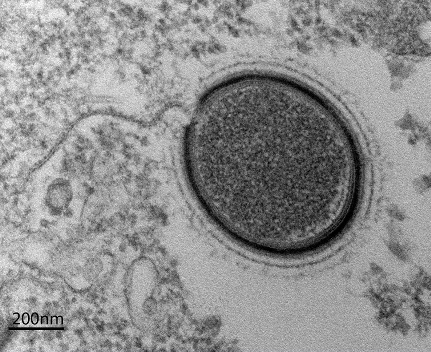 В 2015 году медицинские ученые из Университета Экс-Марсель обнаружили вирус Mollivirus sibericum в вечной мерзлоте Сибири.