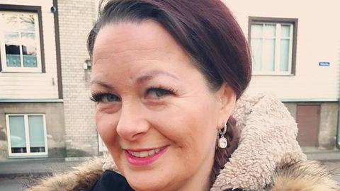 Жуть! 37-летняя эстонская блогер показала, как выглядит ее лицо без ботокса