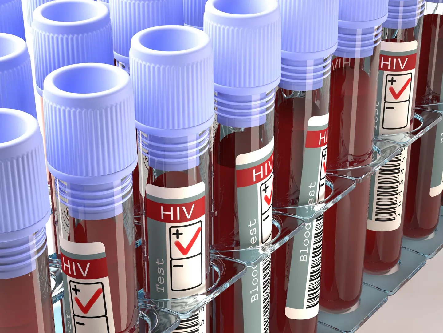 Kokku avastati Eestis 2019. aastal 178 uut HIV-juhtu.
