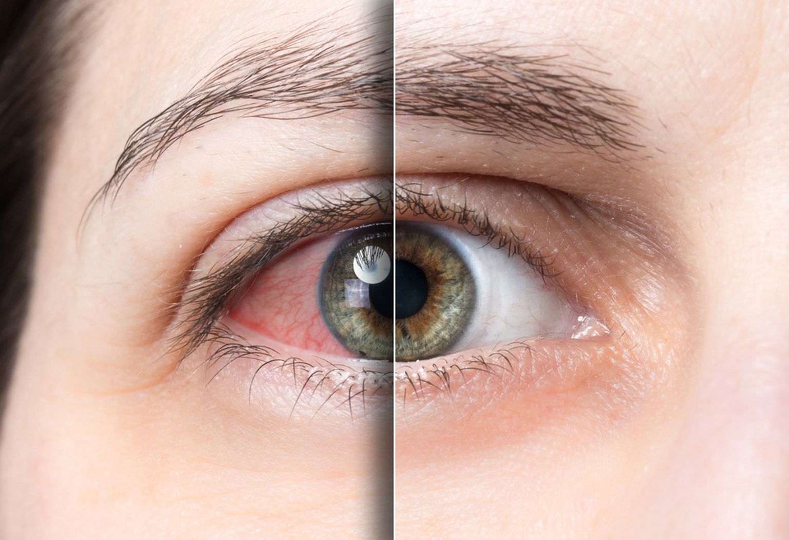 Lisaks silmahaigustele võivad nägemist mõjutada ka kaasasündinud silmakuju, erinevad valgust kiirgavad seadmed või lihtsalt vananemine.