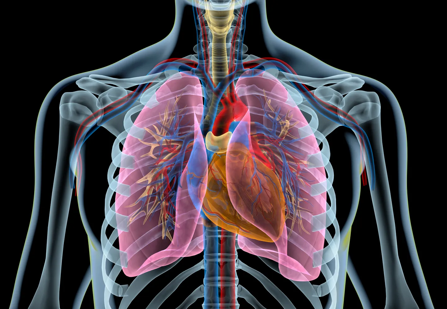 Human heart with vessels, lungs, bronchial tree and cut rib cage. X-ray.